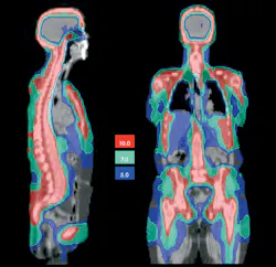 The Congressional Research Service compared CT Checkpoint Screening technology with 2D X-Ray and concluded that CT had big advantages: higher throughput, better threat detection, and automated threat detection. The Congressional Research Service compared CT Checkpoint Screening technology with 2D X-Ray and concluded that CT had big advantages: higher throughput, better threat detection, and automated threat detection.