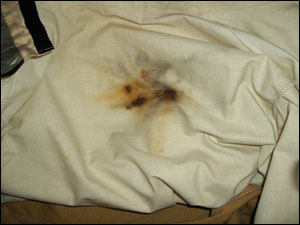 While the firefighter found two very small blisters on his back the following morning, his turnout gear did its job of protecting him from harm. This incident points to the need to wear all protective equipment.