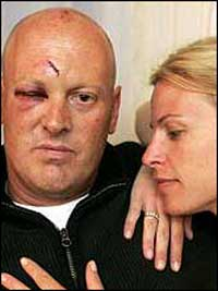 Fire Lt. Christopher Corwin, with his wife Liz, is recovering from a vicious beating.