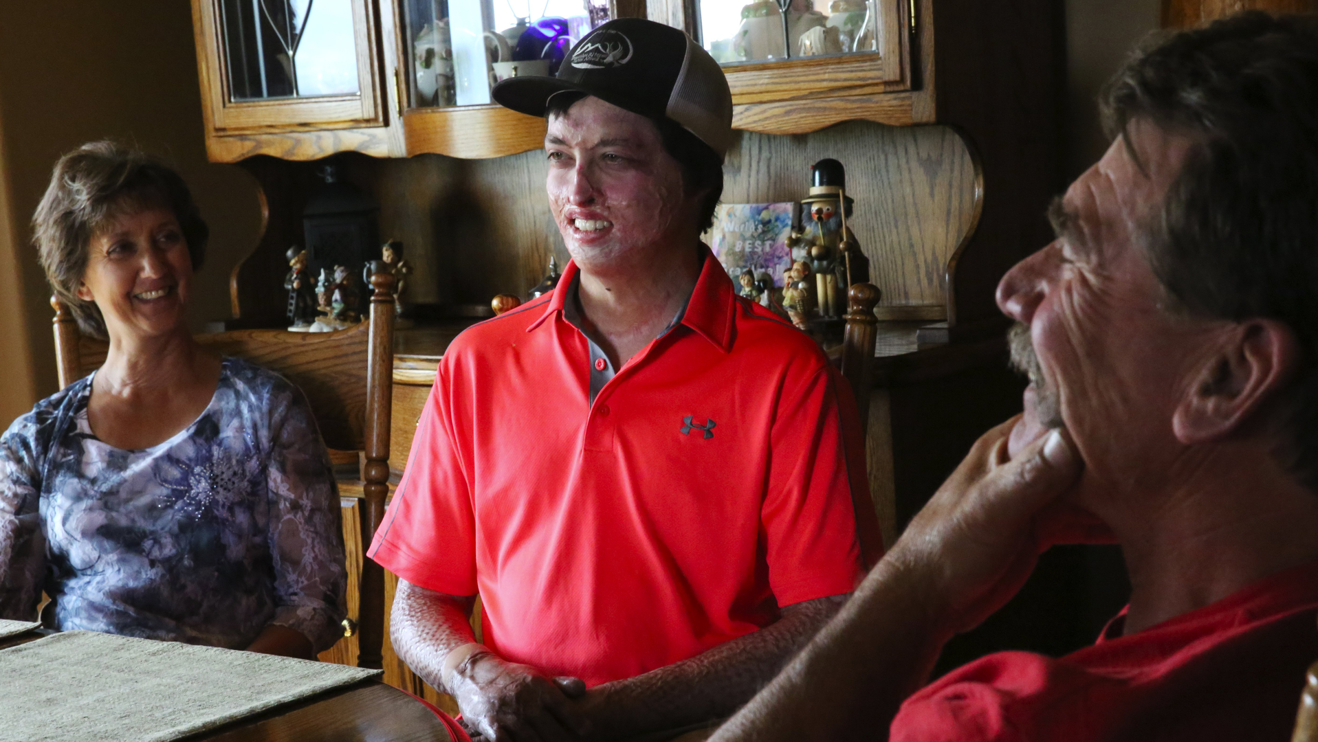 Daniel Lyon Jr., a firefighter badly burned in the 2015 Twisp River, WA.