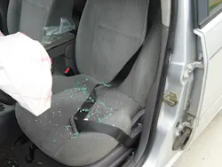 The unrewound seatbelt indicates that the seatbelt pretensioner fired off. In a circumstance such as this, you can believe a patient’s account of having been belted. The unrewound seatbelt indicates that the seatbelt pretensioner fired off. In a circumstance such as this, you can believe a patient’s account of having been belted.