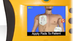 New AED technology has made it possible to merge audio, video, training, and maintenance capabilities into an easy-to-use device that gives confidence to individuals in rescue situations. New AED technology has made it possible to merge audio, video, training, and maintenance capabilities into an easy-to-use device that gives confidence to individuals in rescue situations.
