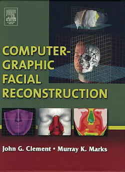 Computergraphicfacialreconstruction 10040626 Computergraphicfacialreconstruction 10040626