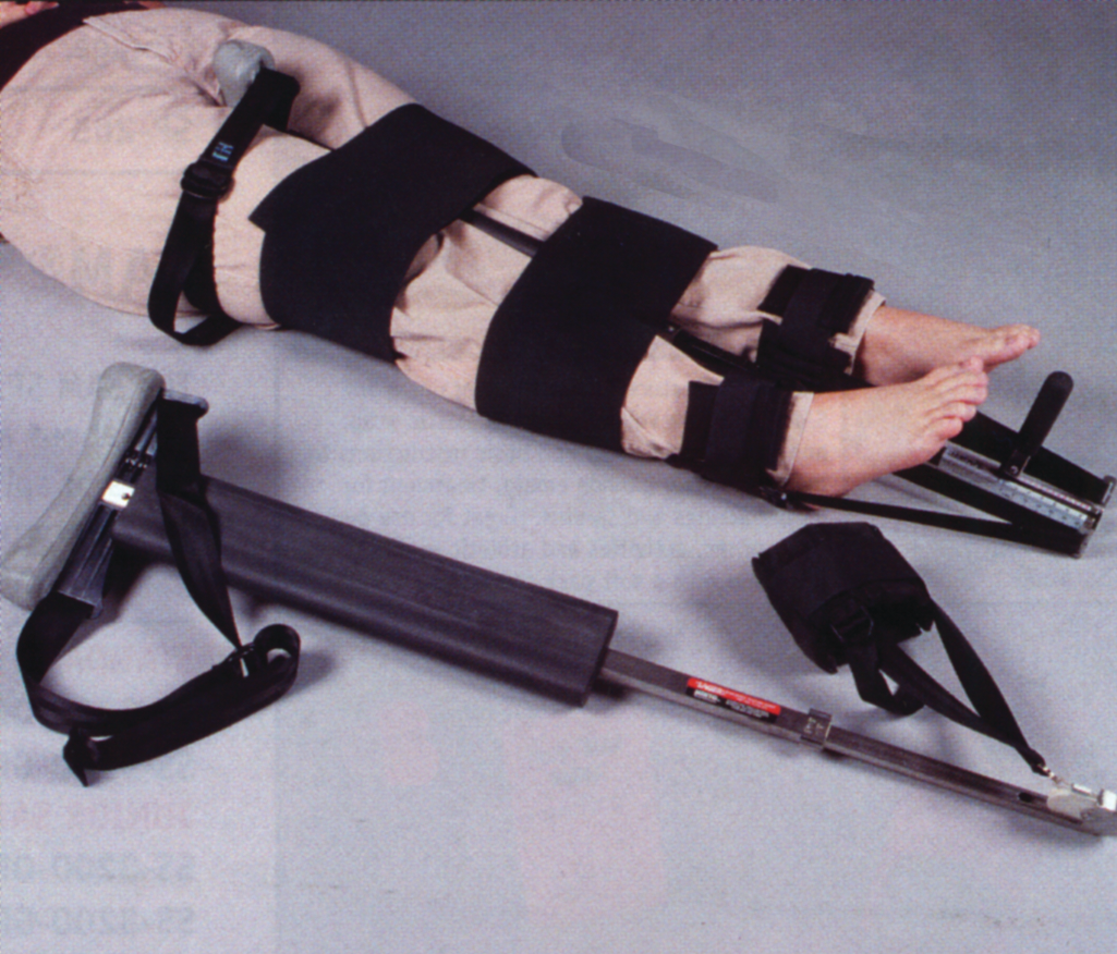 Mintosagerformiiitractionsplints 10044566