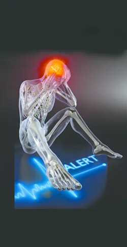 Stress Aleert 54ac2028921fb Stress Aleert 54ac2028921fb