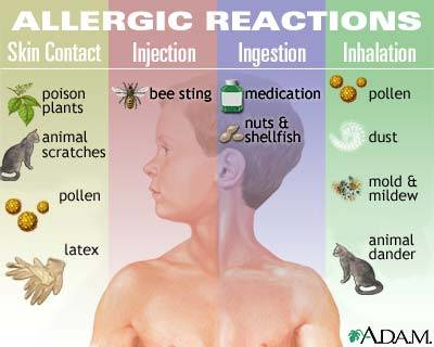 Allergy Pinterest 58f4ba1728b98