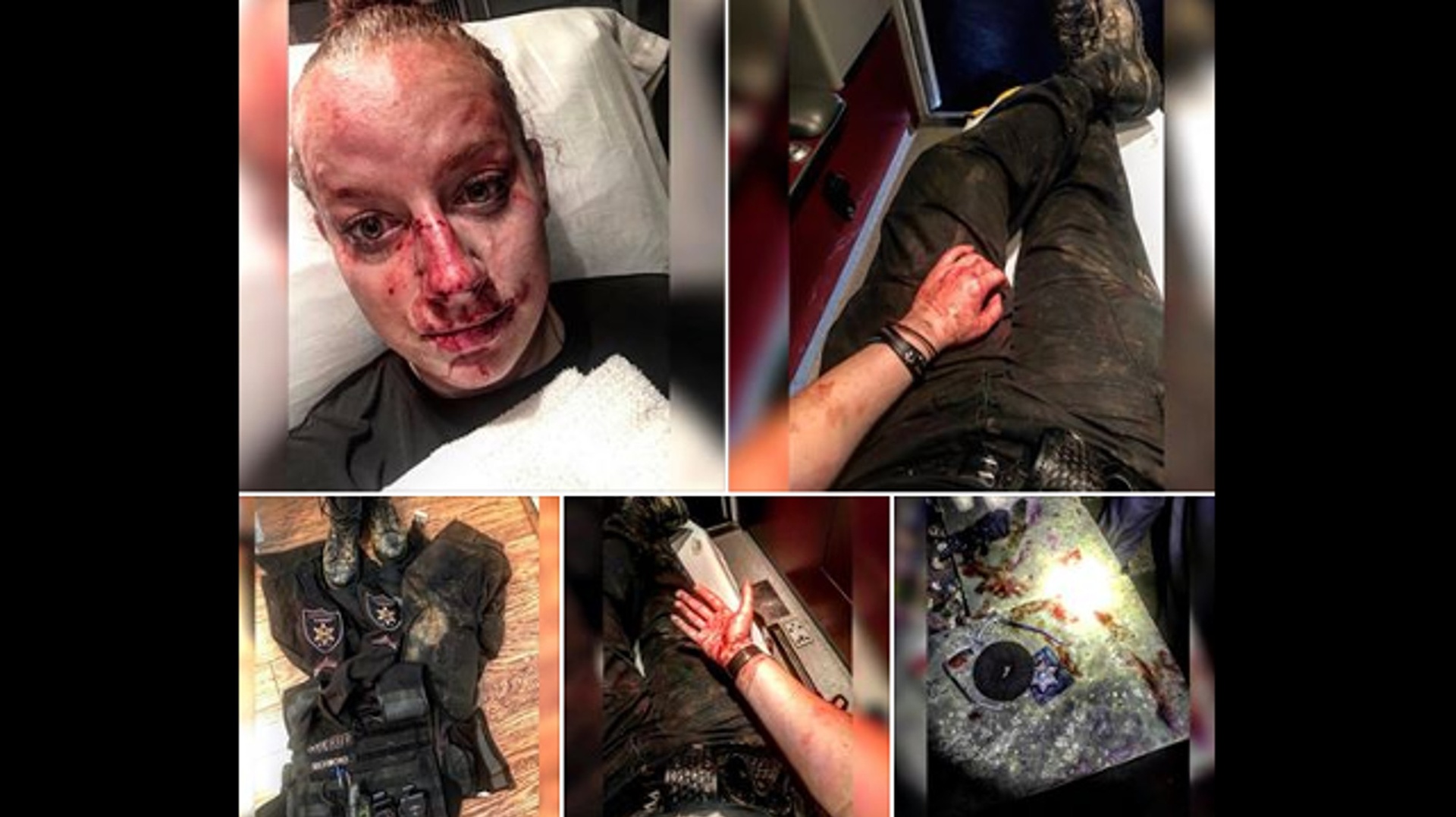 Brooke County Sheriff's Deputy Kristen Richmond, who was beaten in a struggle with a suspect early Friday morning, posted photos of her injuries and an account of the incident to Facebook which has since gone viral.