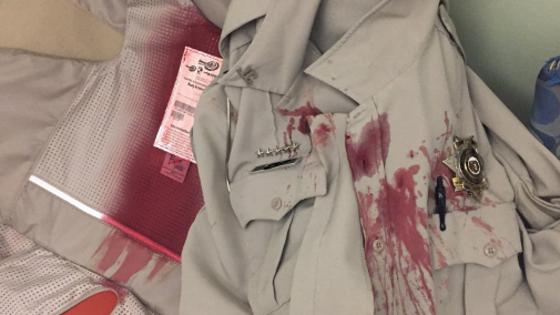 A Jefferson County Sheriff&rsquo;s deputy was discharged from a hospital Thursday after being attacked by a dog while on duty earlier in the week.