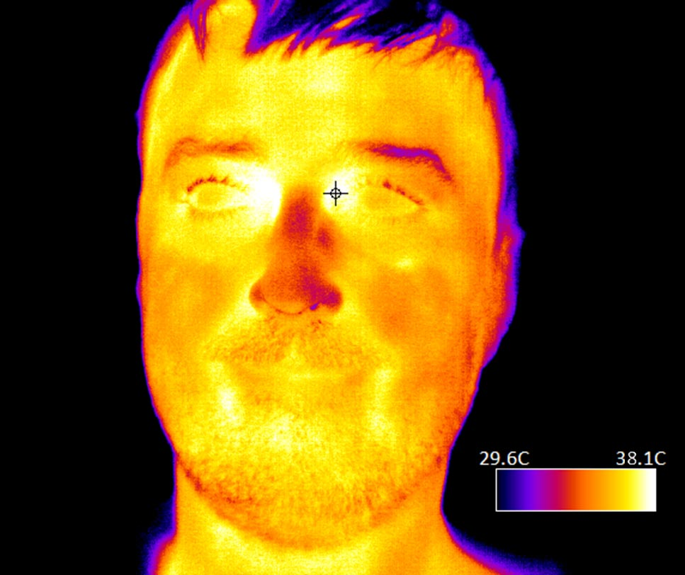 Fever1 5e9e15cef0473