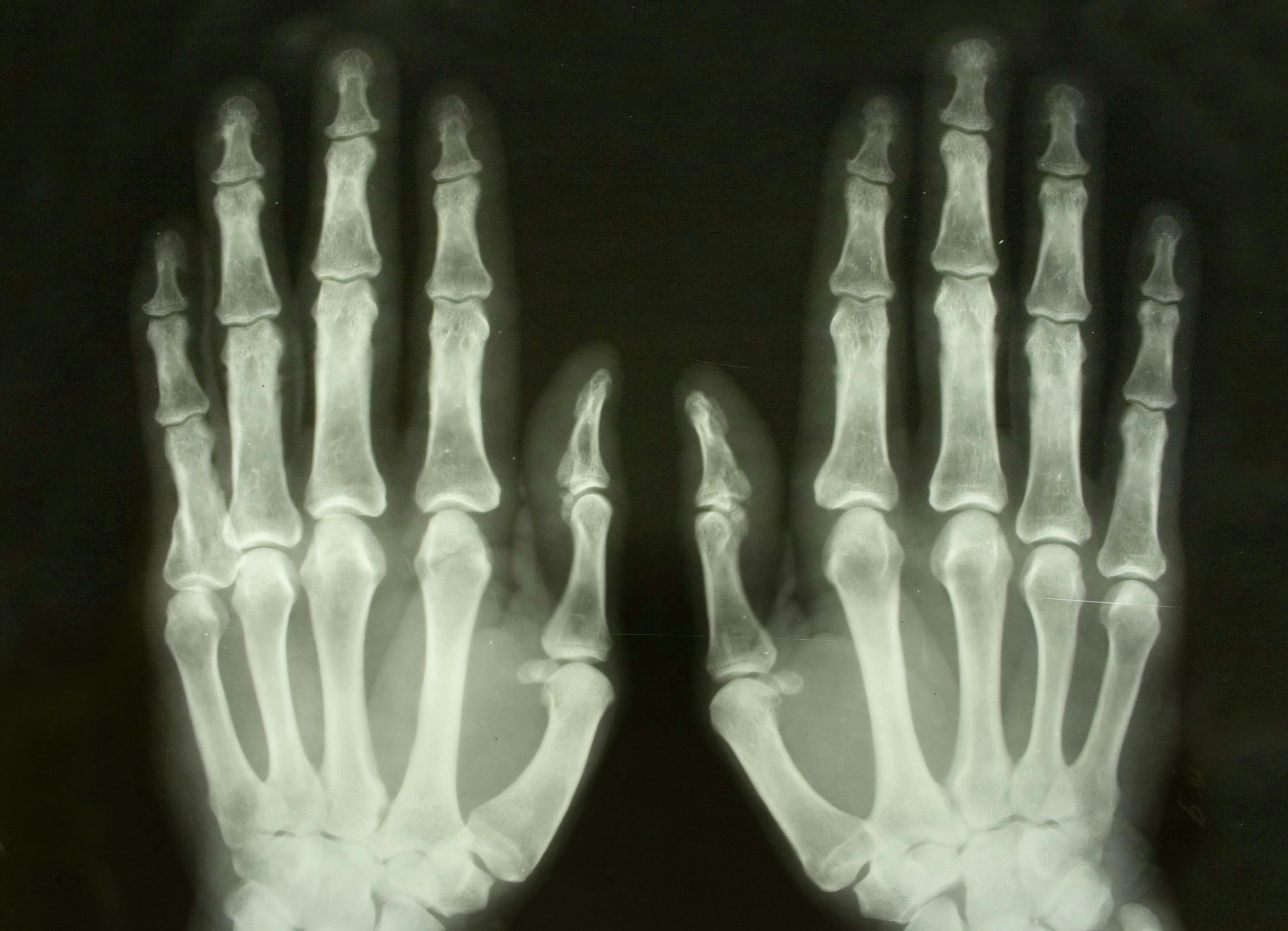 66fb1c14783cc92404d80a7a Hand