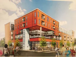 Csf%20rendering%2 A jpg Csf%20rendering%2 A jpg