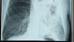 1652285632032 Xraylegionnaire 1652285632032 Xraylegionnaire