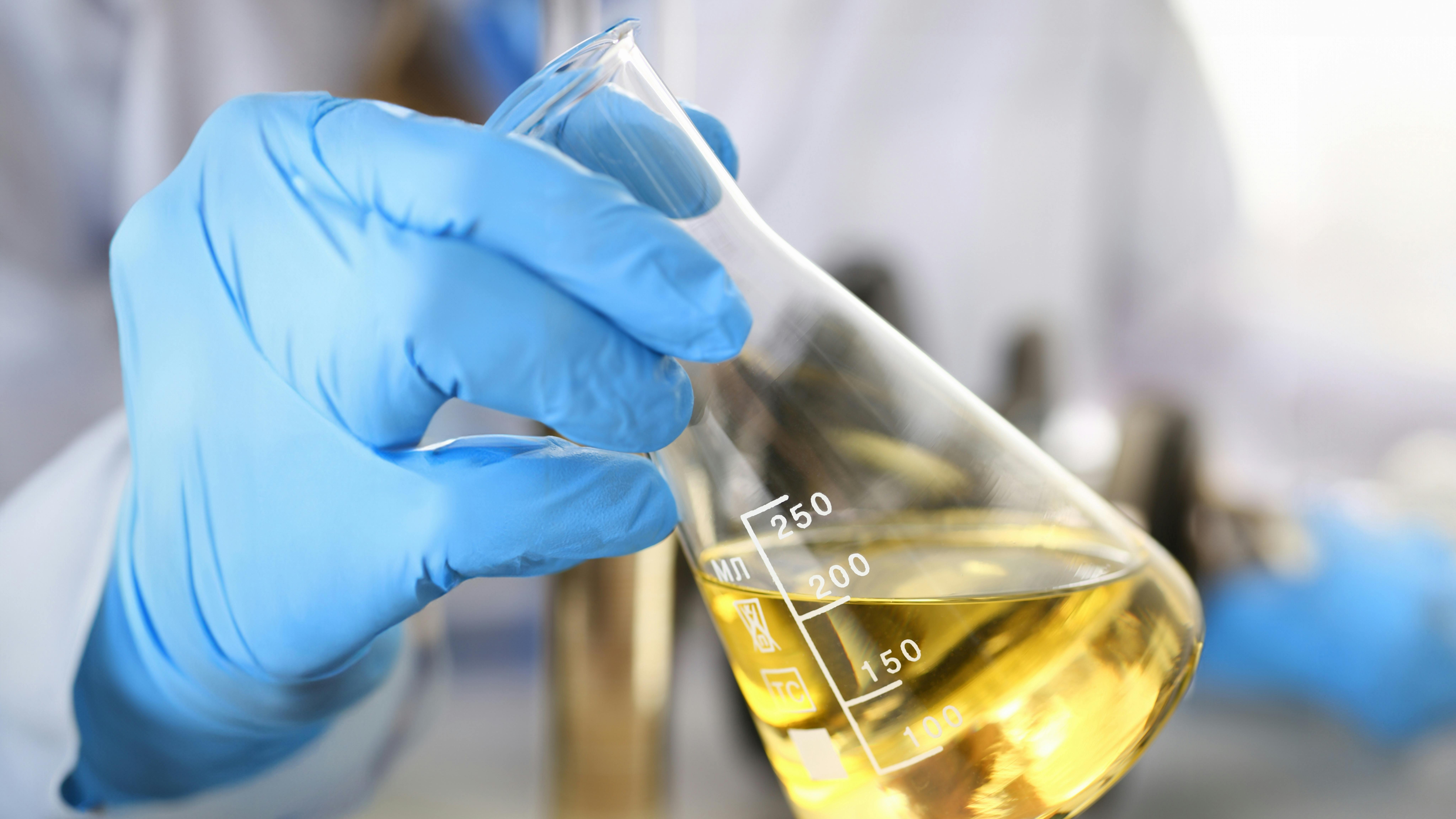 hands in protective gloves hold test tube filled with liquid chemical for testing