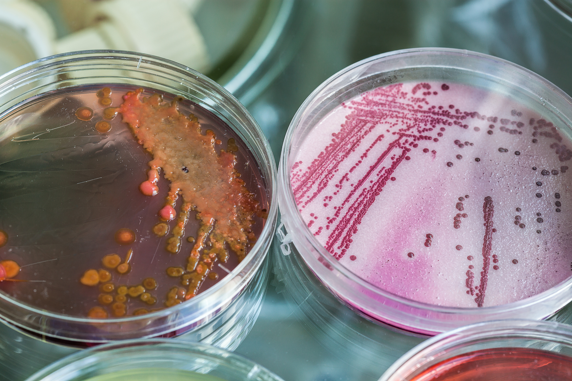 Legionella2 5e7e5b5eb9f8a