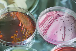 Legionella2 5e7e5b5eb9f8a Legionella2 5e7e5b5eb9f8a