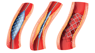 1660319172949 0318atefigure1small