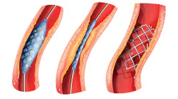 0318-ATE-Figure-1-Small 0318-ATE-Figure-1-Small