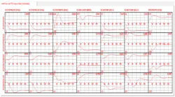 CG1401-MVC2 CG1401-MVC2