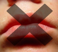 1660604670200 Cg1106 Mouth