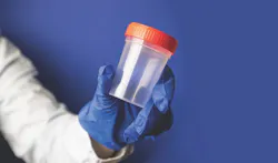 Gloved hand holding urine sample cap for marijuana testing Gloved hand holding urine sample cap for marijuana testing