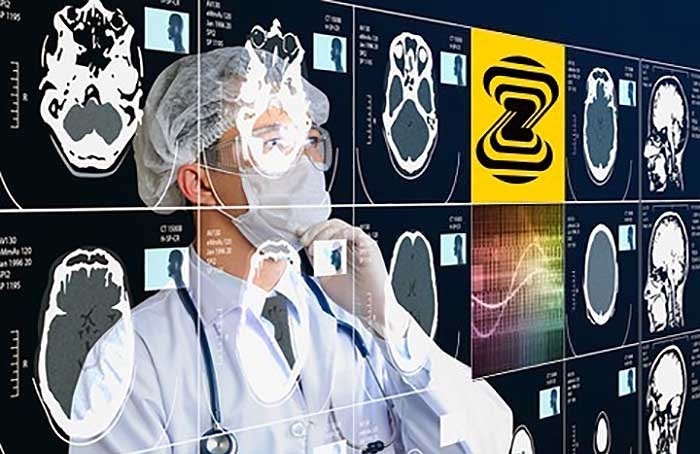 Zebra Medical is among the startups seeking to use artificial intelligence to provide new capabilities in medical imaging and diagnosis. (Image: Zebra Medical/BusinessWire)