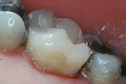 1504depre P03 1504depre P03