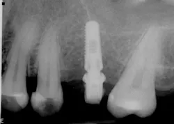 1506deyoo P14 1506deyoo P14