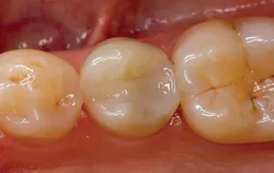 1508debas P02 1508debas P02