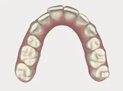 1511defor P01 1511defor P01