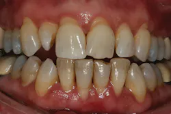 1511defor P03 1511defor P03