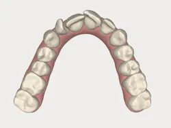 1511defor P04 1511defor P04