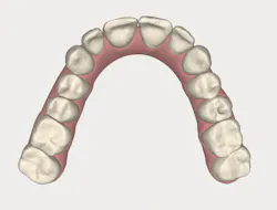 1511defor P06 1511defor P06