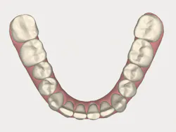 1511defor P07 1511defor P07