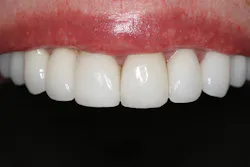 1511defor P09 1511defor P09