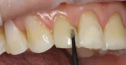 1511defor P12 1511defor P12