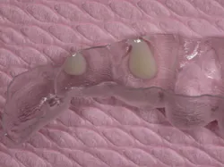 1511defor P13 1511defor P13