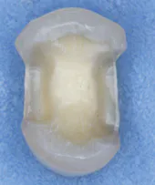 Chr Slide3 Chr Slide3