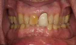 Ditolla Dr Michael De Jan 2014 Figure 2 Ditolla Dr Michael De Jan 2014 Figure 2