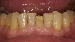 Ditolla Dr Michael De Jan 2014 Figure 3 Ditolla Dr Michael De Jan 2014 Figure 3