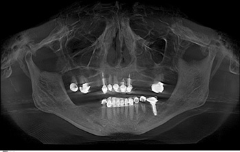 New Agarwal Image Of Xray