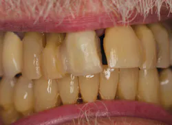 Nylaan Dr Brian De July 12 Before Mg 6855 Nylaan Dr Brian De July 12 Before Mg 6855