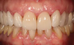 P1406defer05 P1406defer05