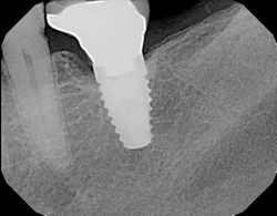 P1410defro01a P1410defro01a