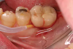 P1410defro02 P1410defro02