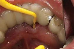 P1410defro03 P1410defro03