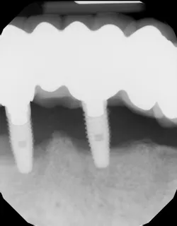 P1410defro03a P1410defro03a