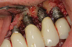 P1410defro04 P1410defro04