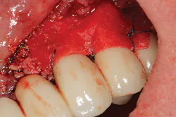 P1410defro05a P1410defro05a