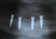 Pennwell web 196 137 Pennwell web 196 137