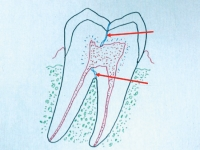 Pennwell web 200 150